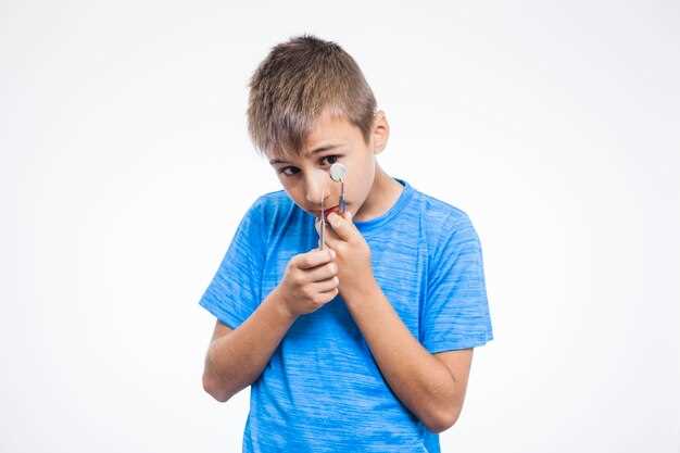 Причины кровотечения из носа у детей