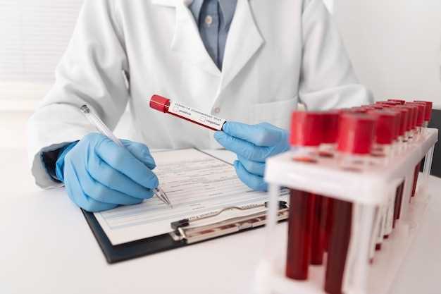 Преимущества экспресс-теста перед обычным тестом на ВИЧ