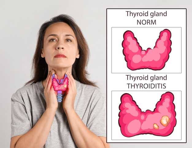 Как проводятся диагностические исследования при подозрении на рак щитовидной железы