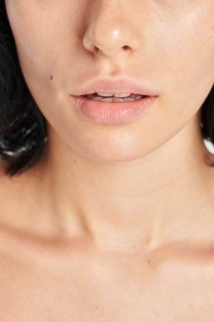 Главные признаки герпеса на губе