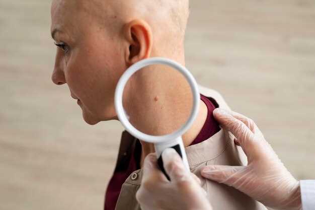 Симптомы рака кожи, на которые нужно обратить внимание