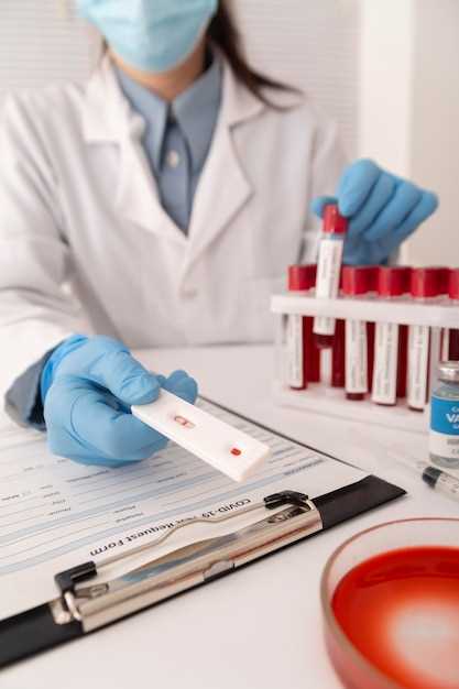 Процесс сдачи клинического анализа крови