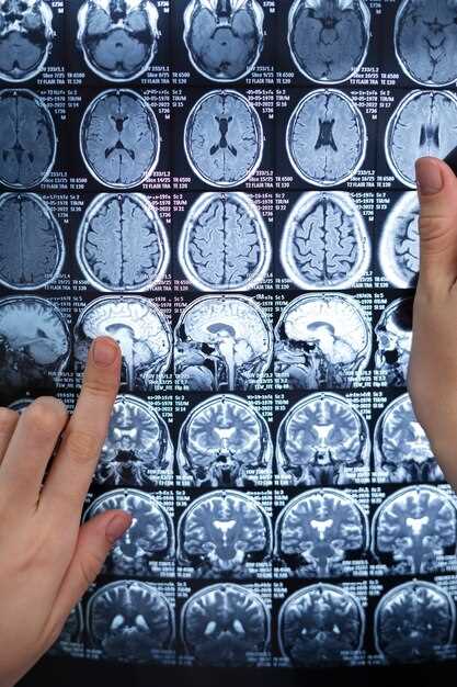 Обнаружение изменений структуры мозга при эпилепсии