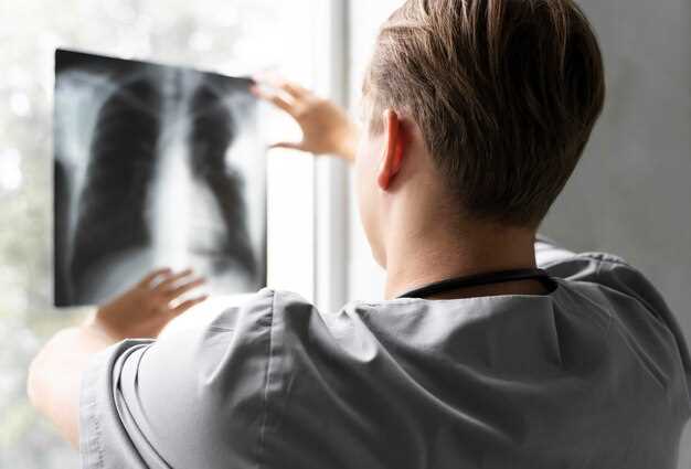 Как диагностируют бронхит с помощью рентгена