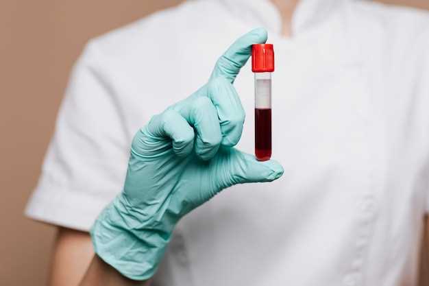 Общий анализ крови: что это и зачем нужно