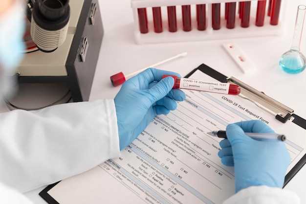Выделение специальных пробирок и маркеров для сохранения крови на ВИЧ и СПИД