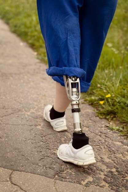 Когда можно начинать ходить после перелома ноги: основные этапы реабилитации