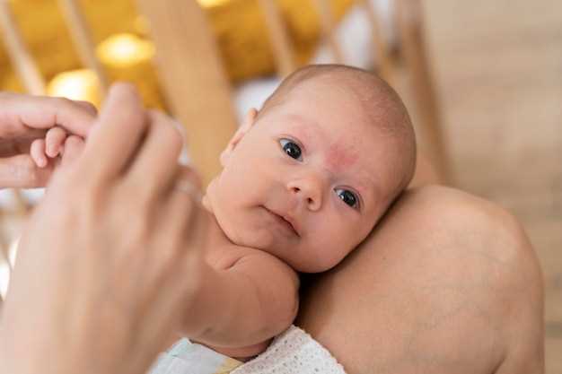 Как правильно ухаживать за кожей новорожденного с потничкой?