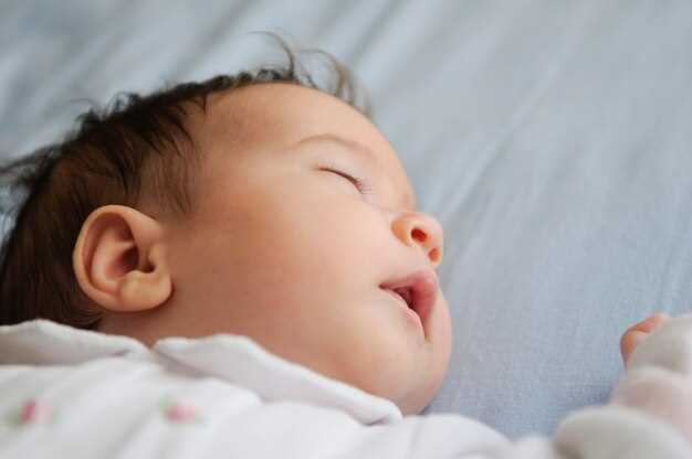 Что такое стоматит у новорожденных и как он выглядит